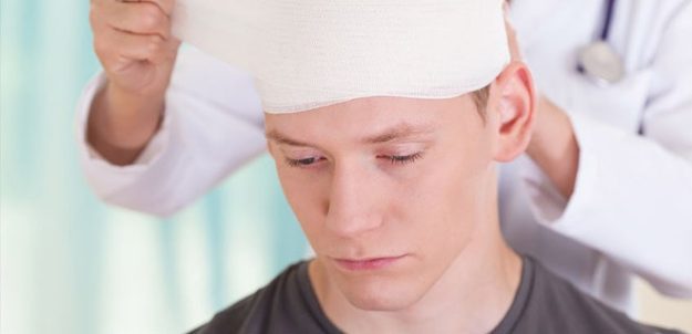 Concussion Myths & Facts